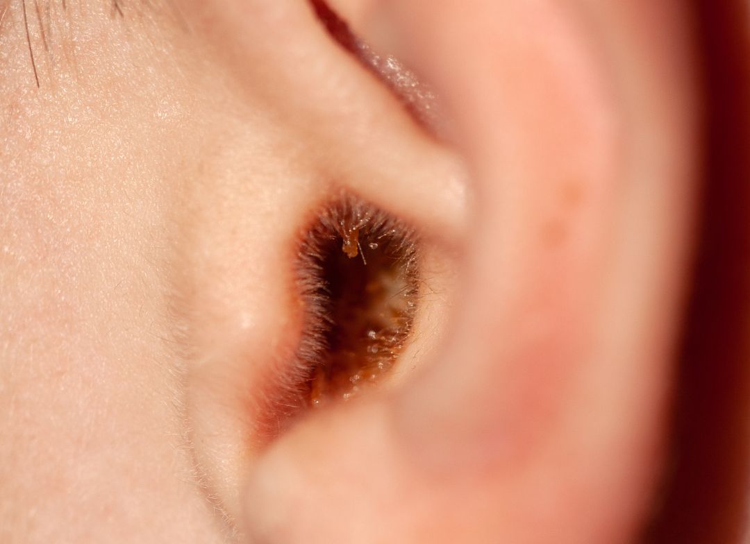 Wet earwax
