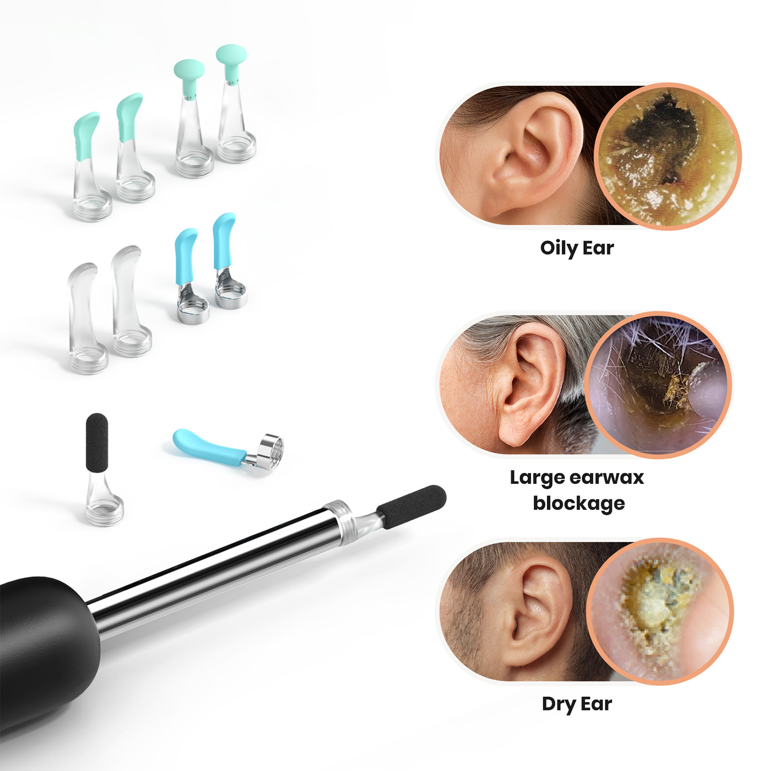 Bebird EarSight R1 & M9 Ohrenschmalzentferner Ersatzspitzen-Set