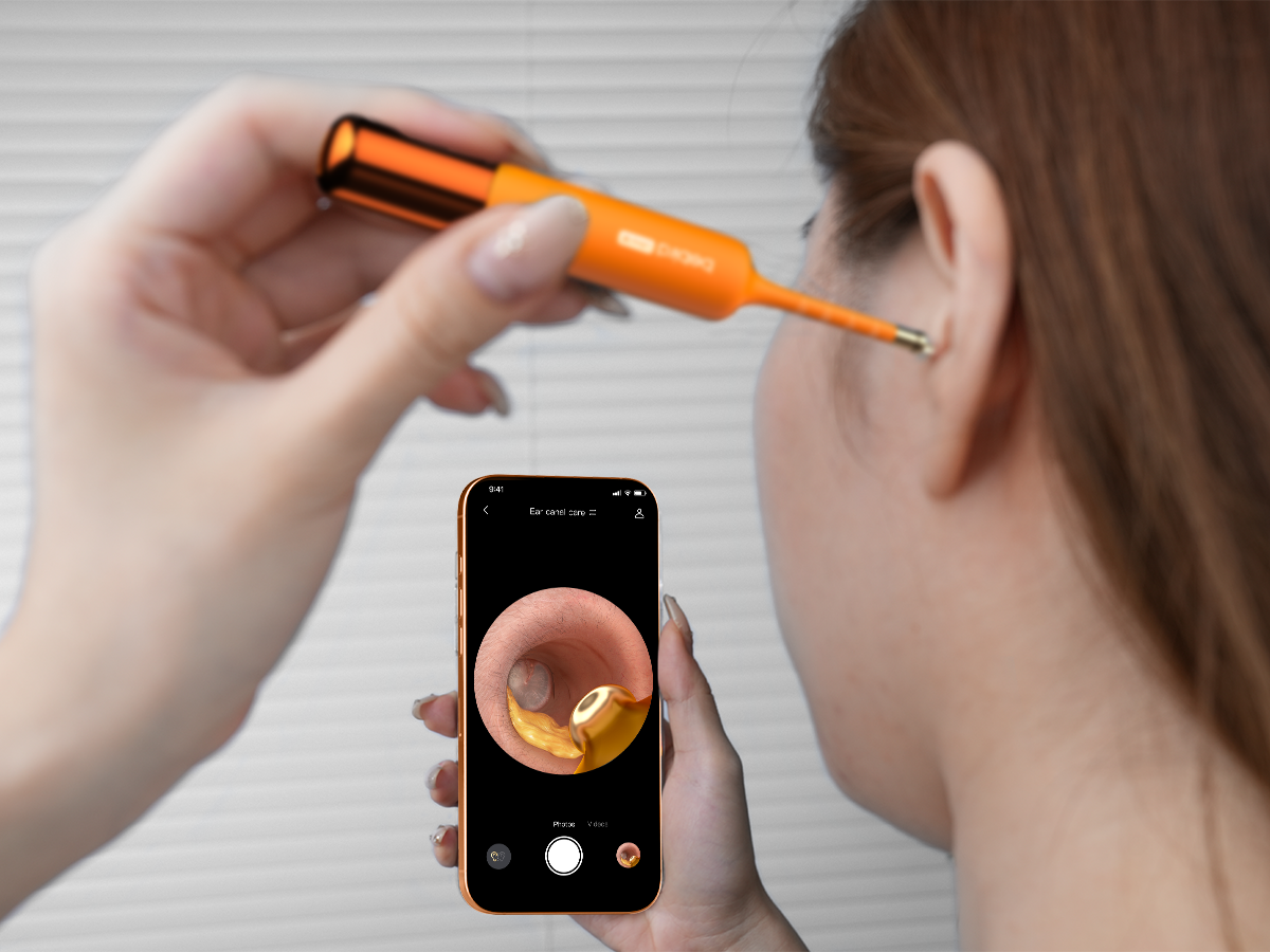 Bebird EU Official Store